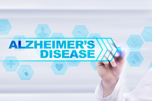 Signs and Duration of Each Stage of Alzheimer's in Montgomery, AL