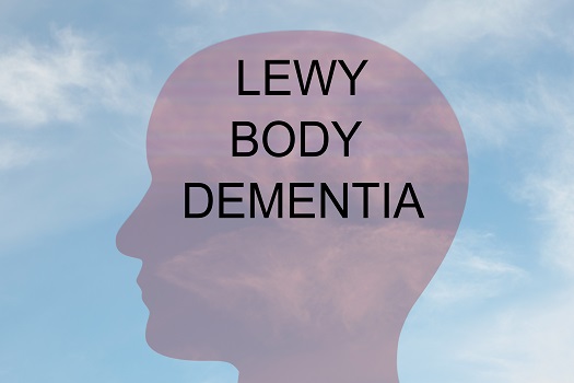 What Is Lewy Body Dementia in Montgomery, AL